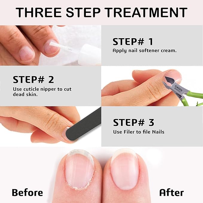 Professional Cuticle Trimmer Nail Cuticle Cutter Stainless Steel Cuticle Nippers with Sharp Blades of Cuticle Remover Clippers Manicure Tools Double Spring for Nail Care Pedicure Nail Tools (Green)
