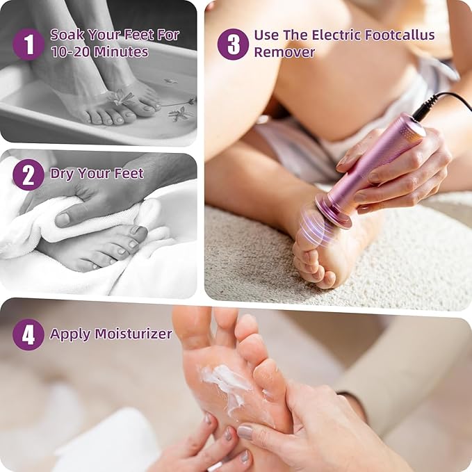 Electric Foot Callus Remover: Feet File Callus Remover with 60pcs Sandpaper Discs - Dead Hard Skin Foot Scrubber for Women -3 Adjustable Speed Pedicure Tools for Feet - Christmas Gift
