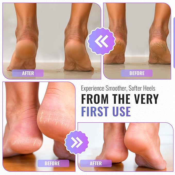 TYGA Colossal Foot Rasp Foot File and Callus Remover - Pedicure Tool for Dead Skin Removal, Feet Hard Skin Remover, Foot Scraper, Can Be Used on Both Wet and Dry Feet, Surgical Grade Stainless Steel