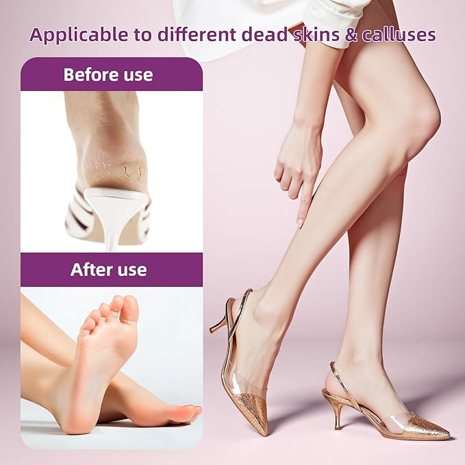 Electric Foot Callus Remover: Feet File Callus Remover with 60pcs Sandpaper Discs - Dead Hard Skin Foot Scrubber for Women -3 Adjustable Speed Pedicure Tools for Feet - Christmas Gift