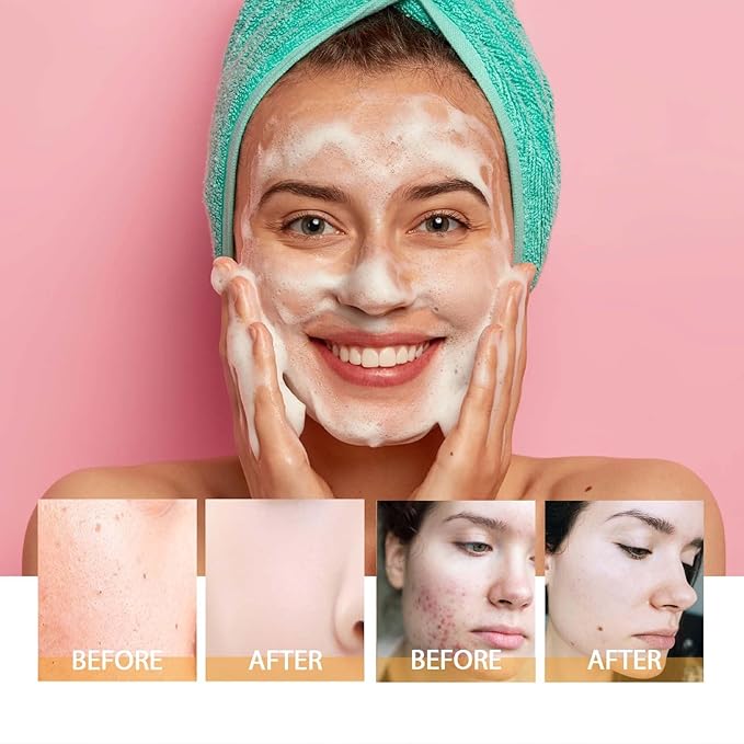 Axnzp 2 Pcs Turmeric Foaming Face Wash, Deep Cleansing Exfoliating Glow Wash Turmeric Brightening Facial Cleanser with Brush for All Skin.