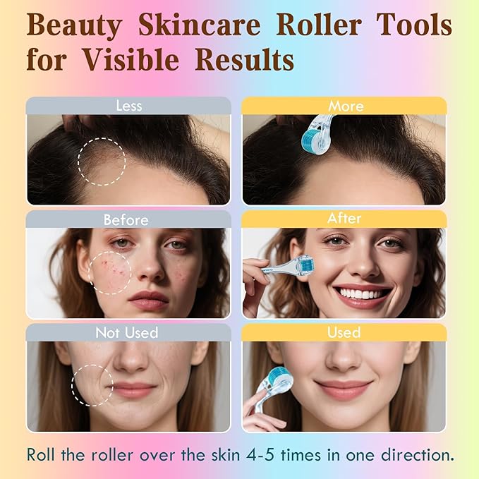 Derma Roller - TUMAKOU Microneedle Roller for Face Scalp Hair - Beard Roller for Women and Men (White)