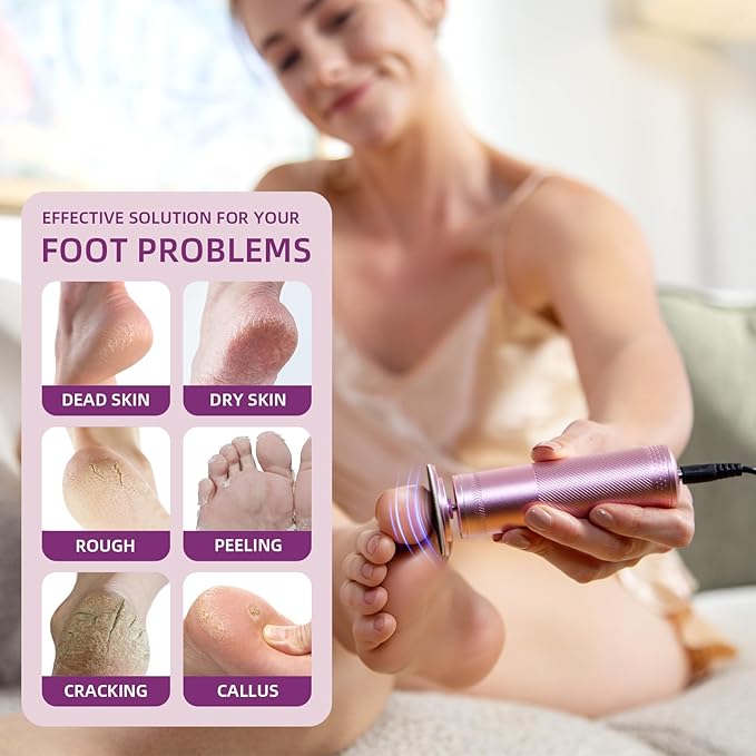 Electric Foot Callus Remover: Feet File Callus Remover with 60pcs Sandpaper Discs - Dead Hard Skin Foot Scrubber for Women -3 Adjustable Speed Pedicure Tools for Feet - Christmas Gift