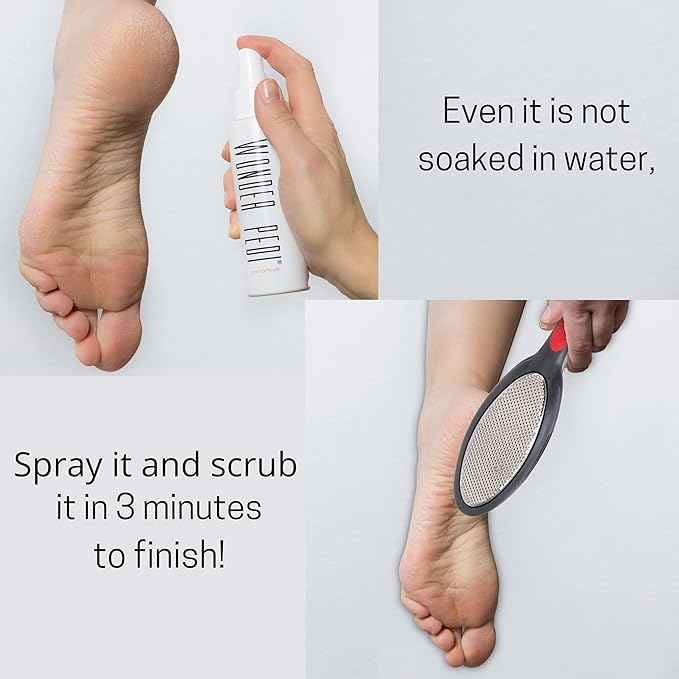 Double Sided Foot File - Made in Germany Feet Scrubber and Feet Softener Callus Remover Spay., Red, 1.0 Count