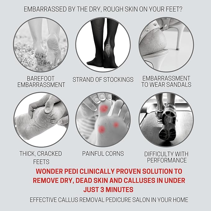 Double Sided Foot File - Made in Germany Feet Scrubber and Feet Softener Callus Remover Spay., Red, 1.0 Count